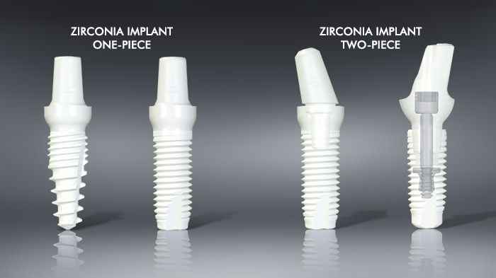 Zirconia Implant