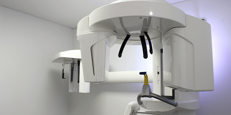 ct-scan-3d-dental-scan