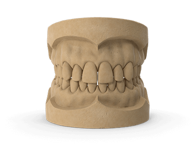 dentists-specialized-in-periodontics-tijuana-symptoms