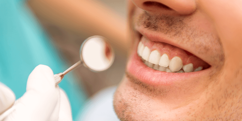 do-i-need-cosmetic-dentistry-for-small-teeth-or-what-is-the-correct-solution