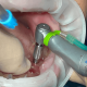 dentalaalvarez-what-is-a-guided-dental-implant-surgery