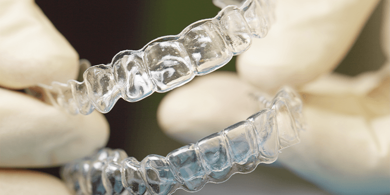 do-you-need-retainer-after-braces