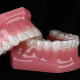 dentalalvarez-how-often-to-replace-invisalign-retainer