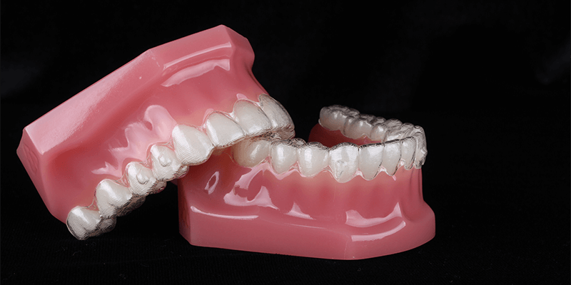 dentalalvarez-how-often-to-replace-invisalign-retainer
