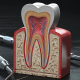 dentalalvarez-when-do-you-need-a-bone-graft