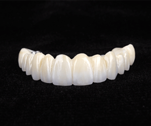 dentalalvarez-learn-about-all-on-four-dental-implants