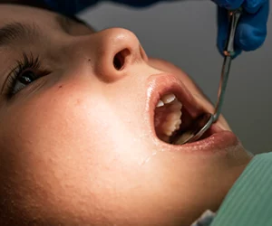 how-to-prepare-children-for-the-dentist