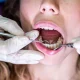 what-is-a-dental-filling-made-of-and-how-long-does-it-last-dental-alvarez-tijuana