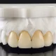 advantages-of-zirconia-teeth-implants-over-other-materials